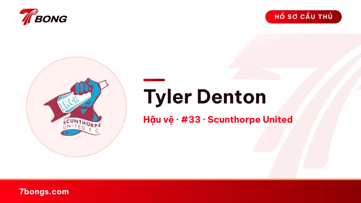 Tyler Denton — Scunthorpe United