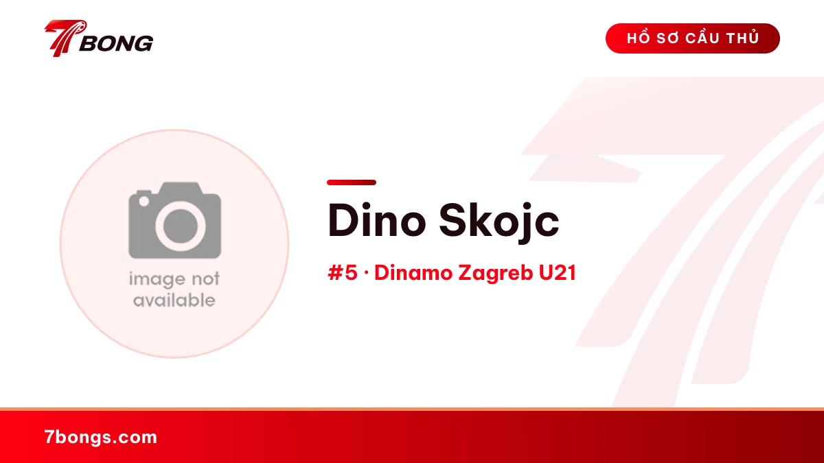Dino Skojc — Dinamo Zagreb U21